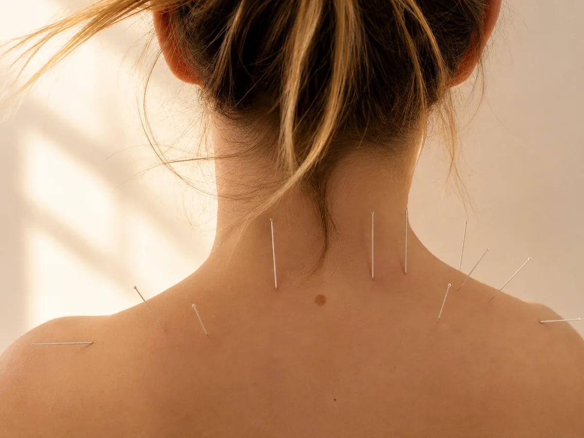 acupuntura dolor cervical tenerife samuel pinero